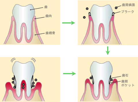 �����a�E�����^�R�̎��Â͔��ˎs�̂���ǂ����Ȉ�@